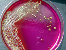 Hóa chất vi sinh E.coli